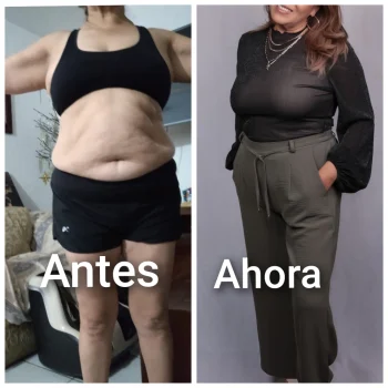 Antes y ahora 4